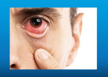 ضایعات بیماری دیابت در شبکیه- 2