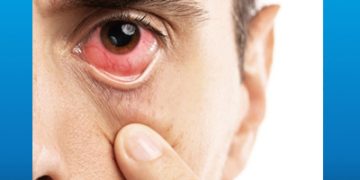 ضایعات بیماری دیابت در شبکیه- 2