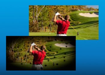 ضایعات بیماری دیابت در شبکیه- 2