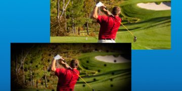 ضایعات بیماری دیابت در شبکیه- 2