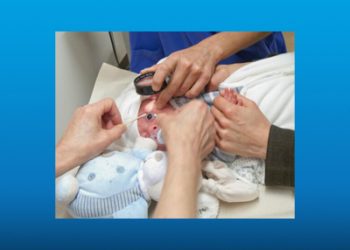 رتینوپاتی نوزادان نارس