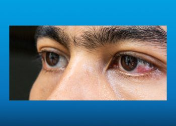 عوارض فشار خون بالا بر شبکیه