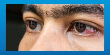 عوارض فشار خون بالا بر شبکیه